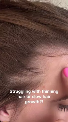 Hair Growth & Thickness Serum - Caffeine & Peptides | MAREE